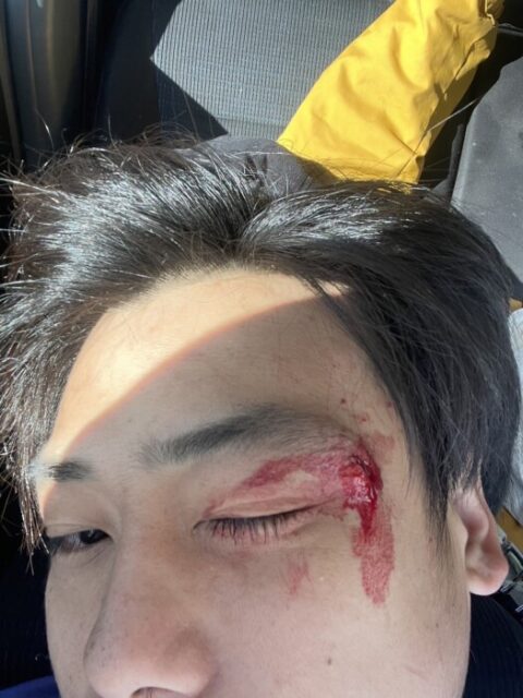 めっちゃ痛かったけど、明日も仕事頑張ろ